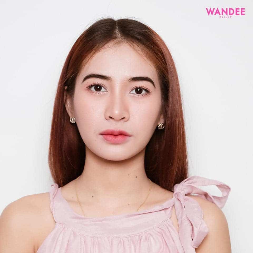 𝗣𝗿𝗼𝗴𝗿𝗮𝗺 𝗙𝗶𝗹𝗹𝗲𝗿 ทุกจุด