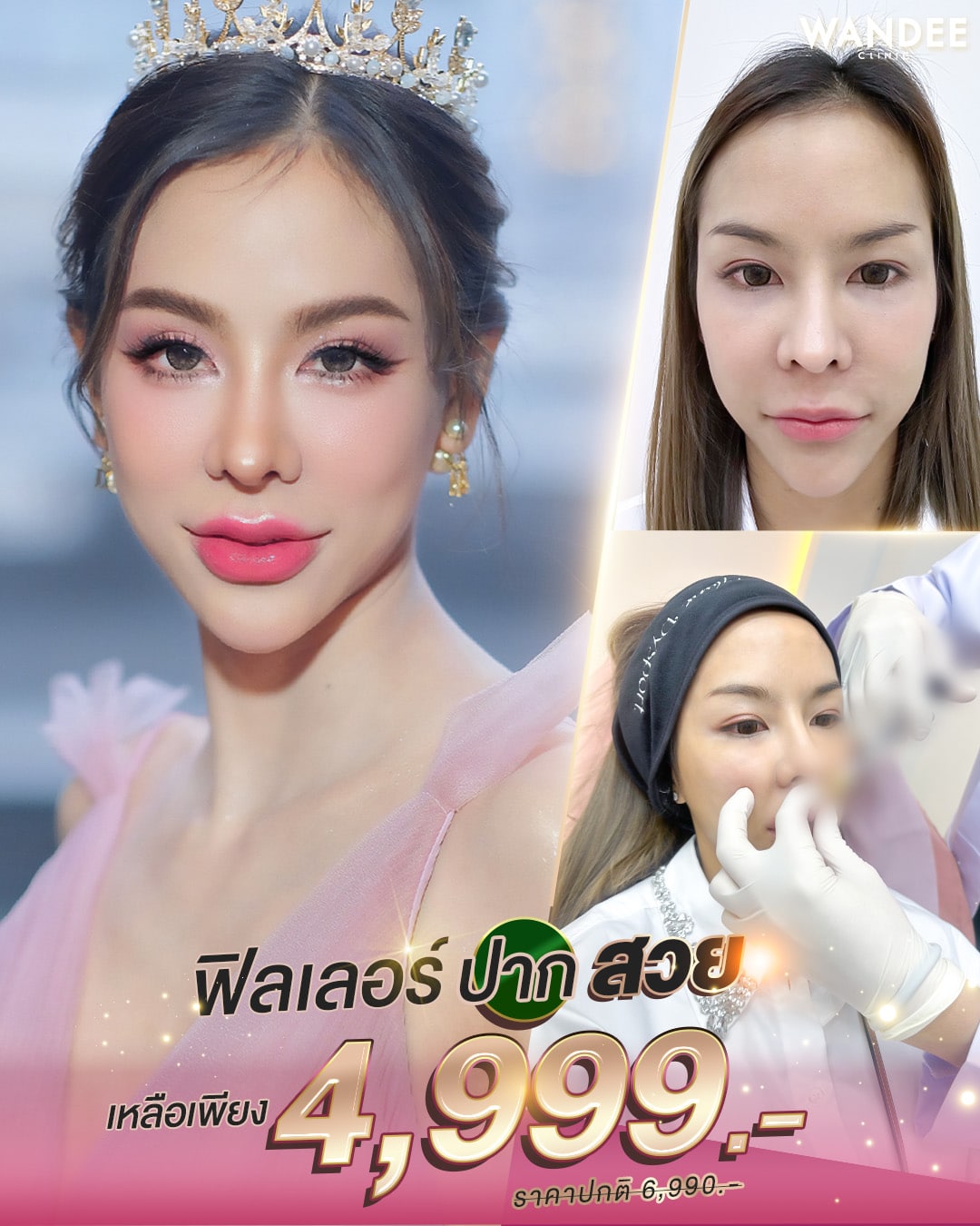 𝗣𝗿𝗼𝗴𝗿𝗮𝗺 𝗙𝗶𝗹𝗹𝗲𝗿 ทุกจุด