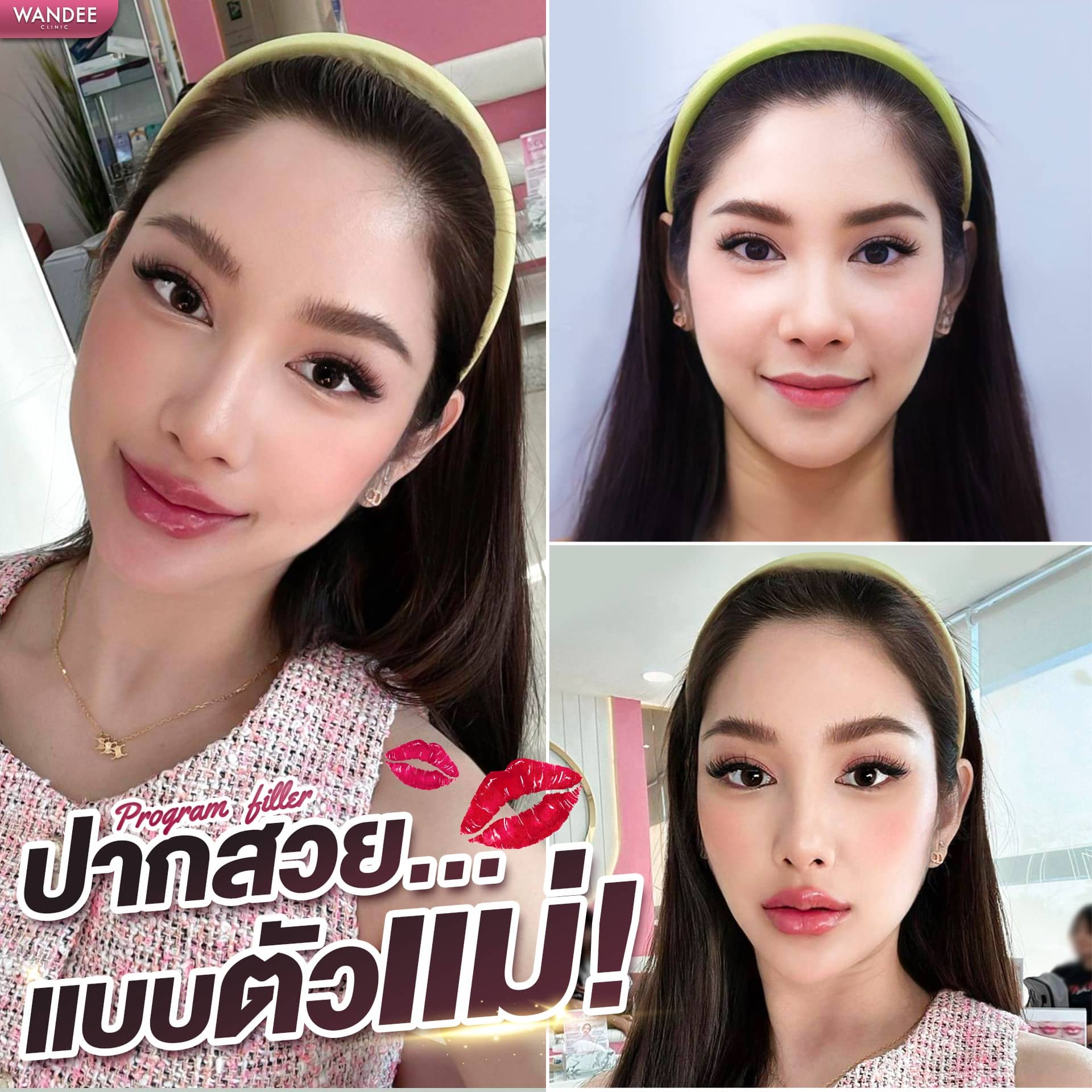 𝗣𝗿𝗼𝗴𝗿𝗮𝗺 𝗙𝗶𝗹𝗹𝗲𝗿 ปาก