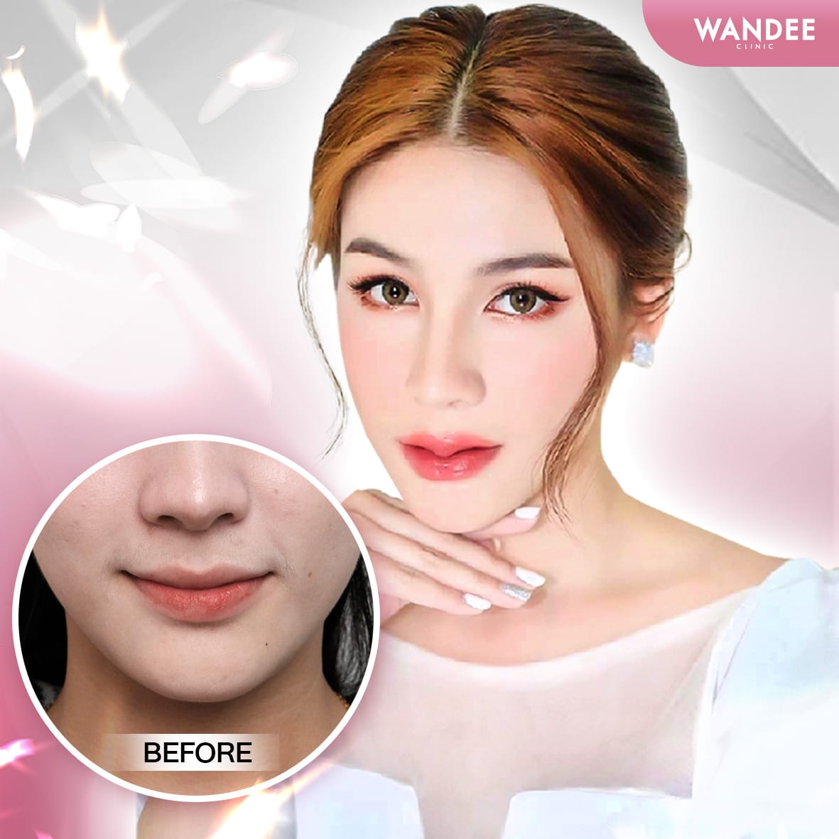 𝗣𝗿𝗼𝗴𝗿𝗮𝗺 𝗙𝗶𝗹𝗹𝗲𝗿