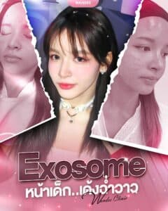 𝐄𝐗𝐎𝐒𝐎𝐌𝐄 หน้าเด็กมาก