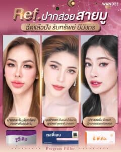 รวมเรฟปากสวย