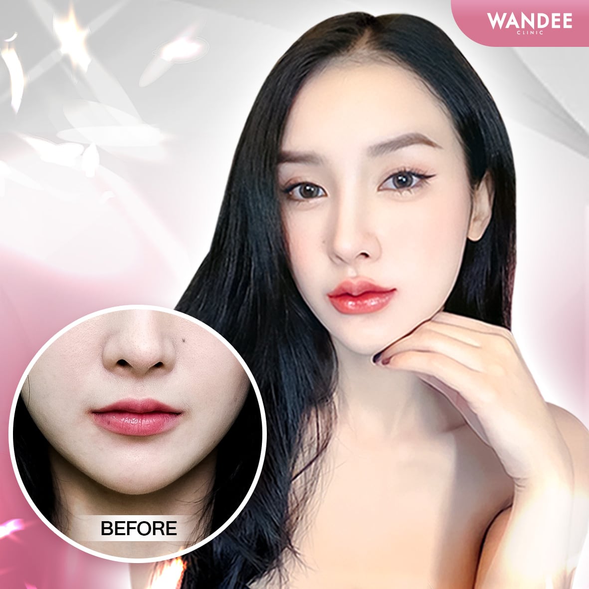 𝗣𝗿𝗼𝗴𝗿𝗮𝗺 𝗙𝗶𝗹𝗹𝗲𝗿