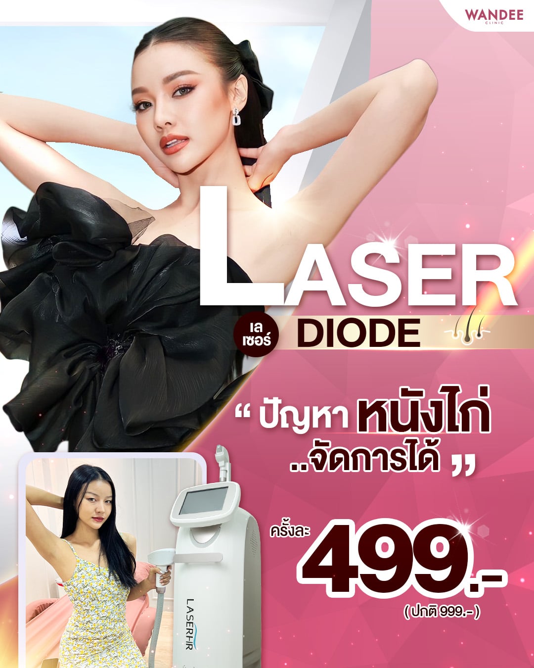 𝐃𝐢𝐨𝐝𝐞 𝐋𝐚𝐬𝐞𝐫 กำจัดขนรักแร้กวนใจ