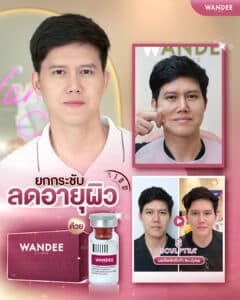 𝗦𝗰𝘂𝗹𝗽𝘁𝗿𝗮 ยกกระชับหน้าหย่อนคล้อย