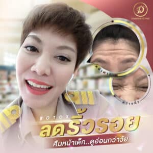 รีวิวโบท็อกซ์