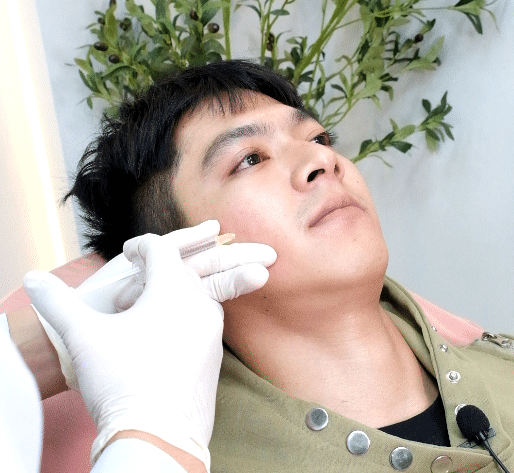 รีวิวเมโสหน้าใส คุณบอส