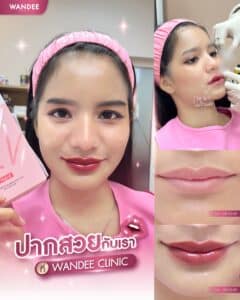 ปากสวยอวบอิ่ม