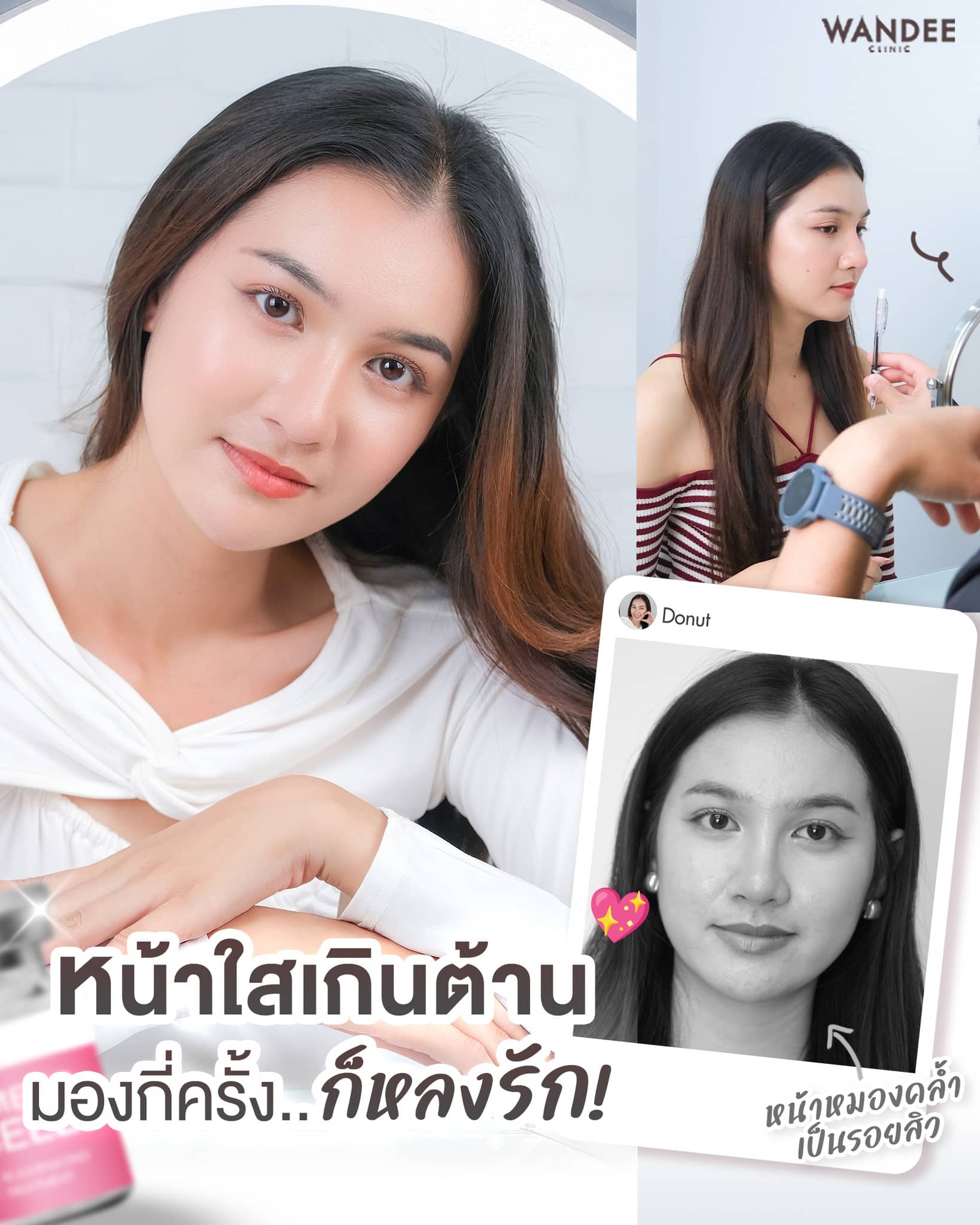 หน้าใสเกินต้าน