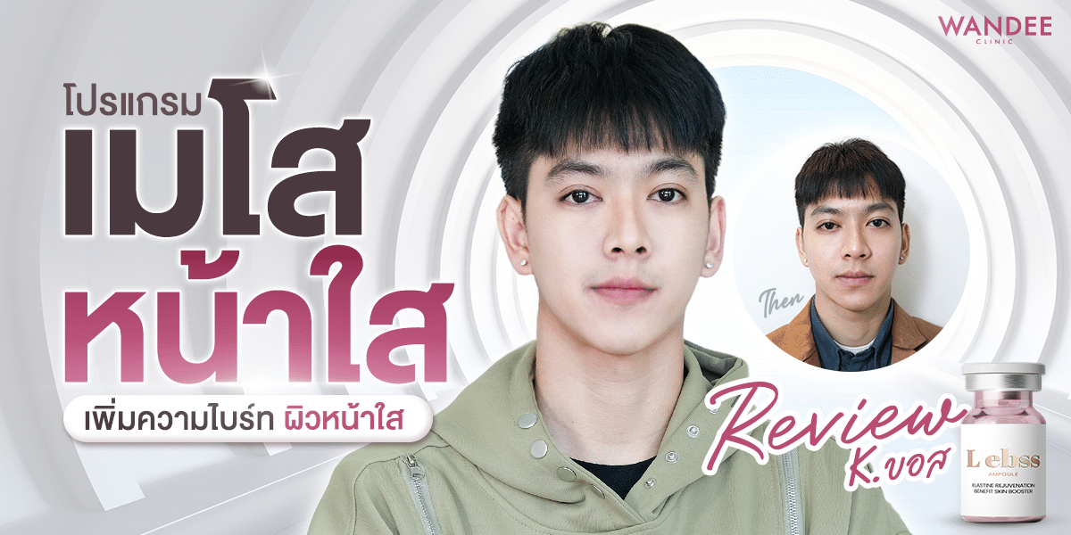 รีวิวเมโสหน้าใส