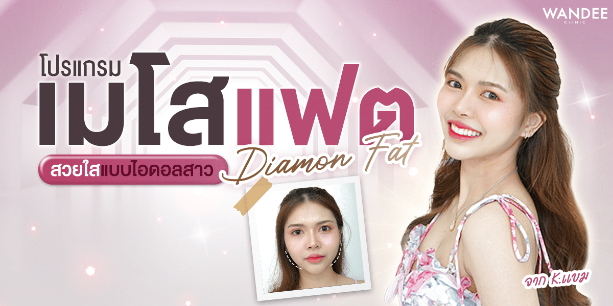 รีวิวโปรแกรมเมโสแฟต