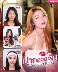 ปากจึ้งเกินต้าน