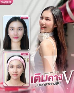 คางเรียวสวย