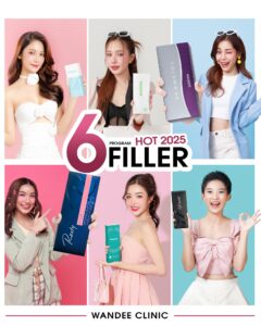 ฟิลเลอร์สุดฮอต