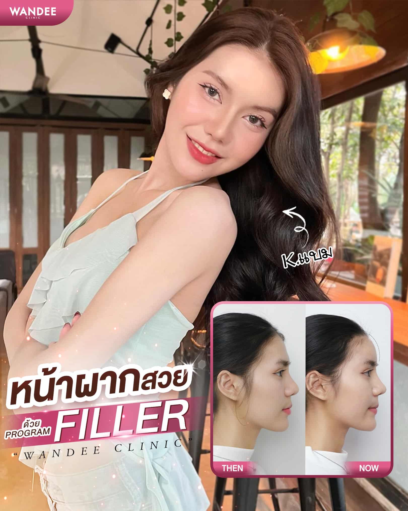 เติมเต็มหน้าผากให้อิ่มพอดี