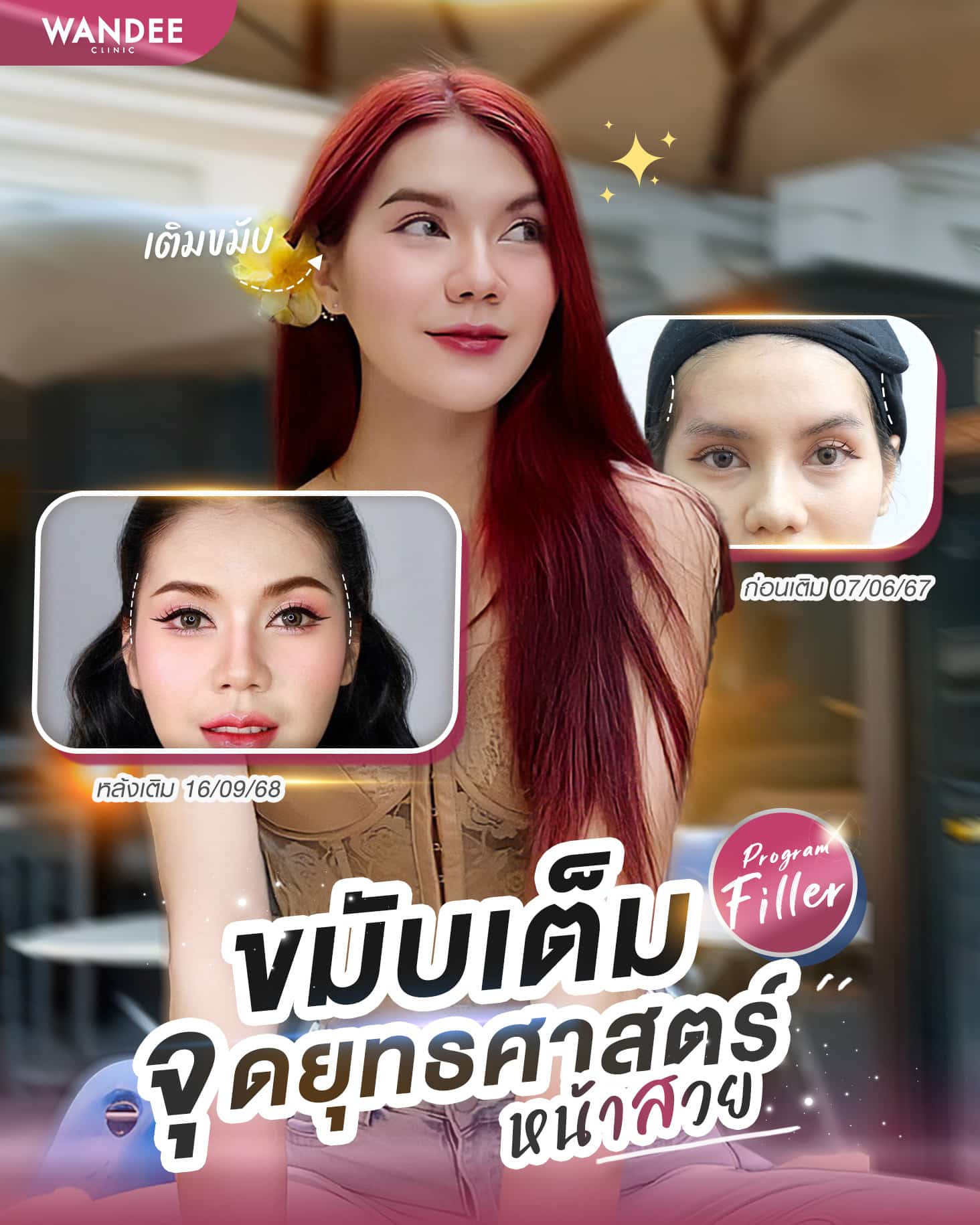 จุดยุทธศาสตร์หน้าสวย