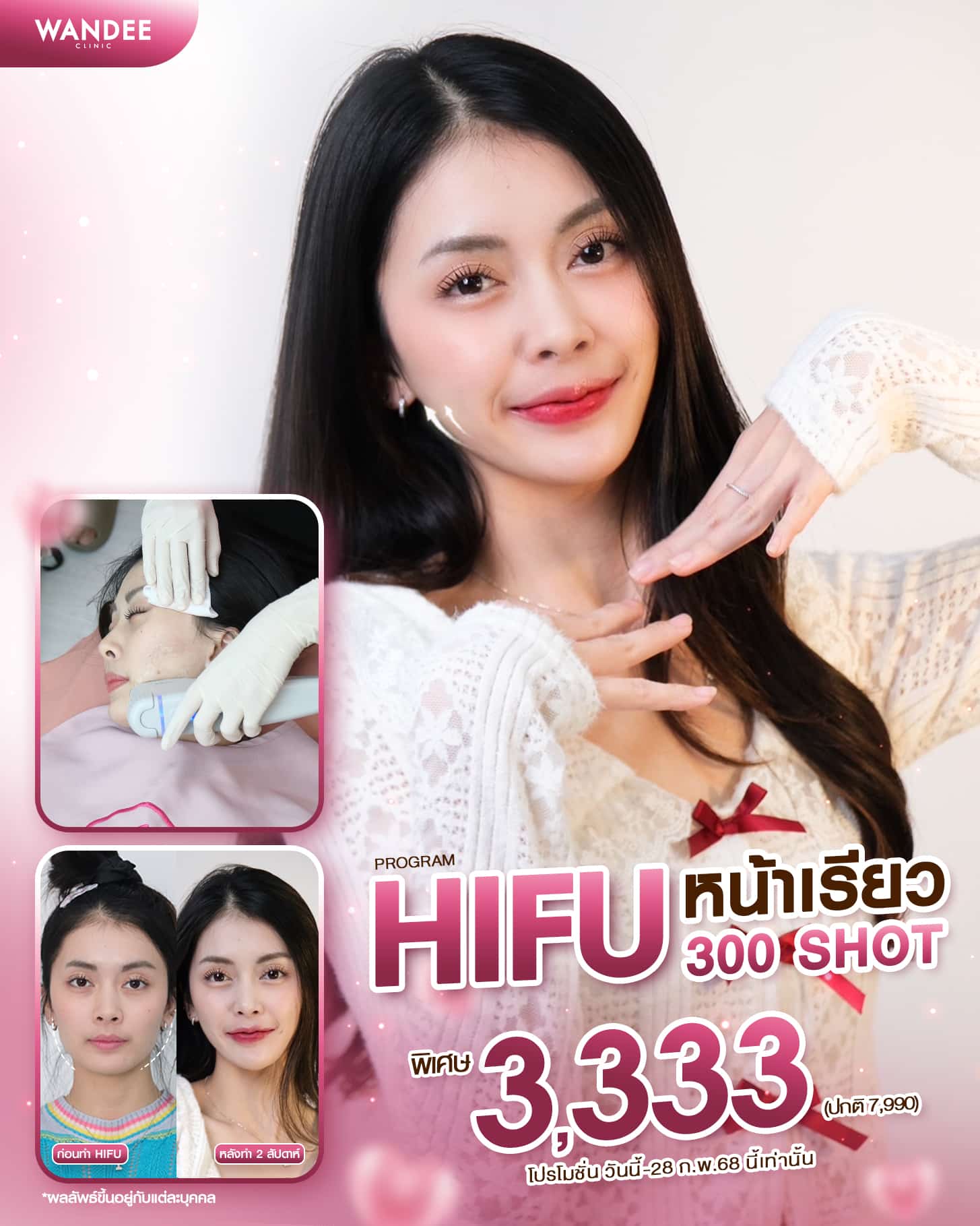 หน้าเรียว กระชับ ใครเห็นก็ต้องหลงรัก