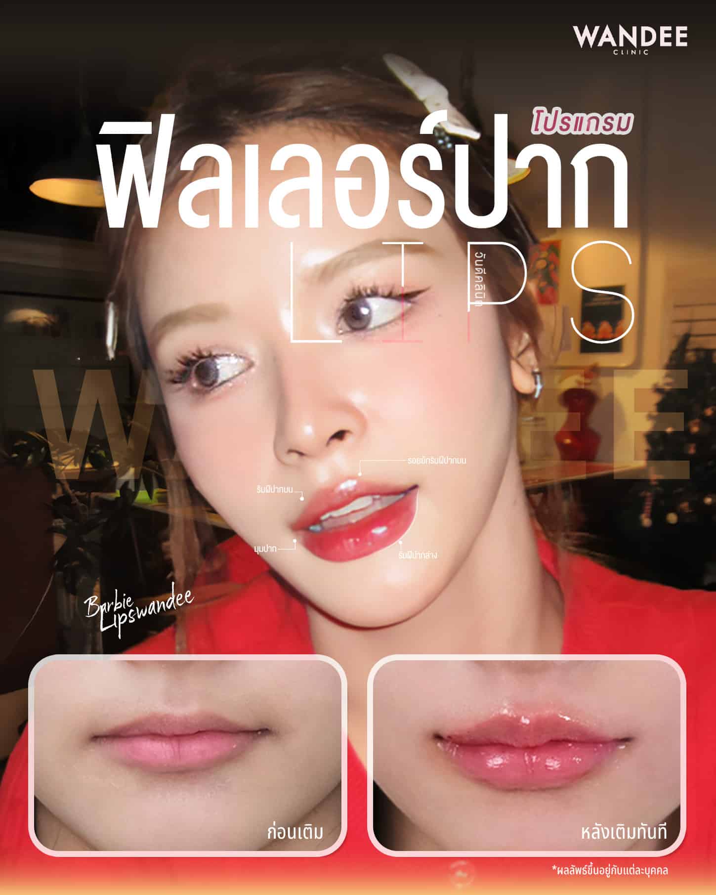 เติมเสน่ห์ให้ปาก