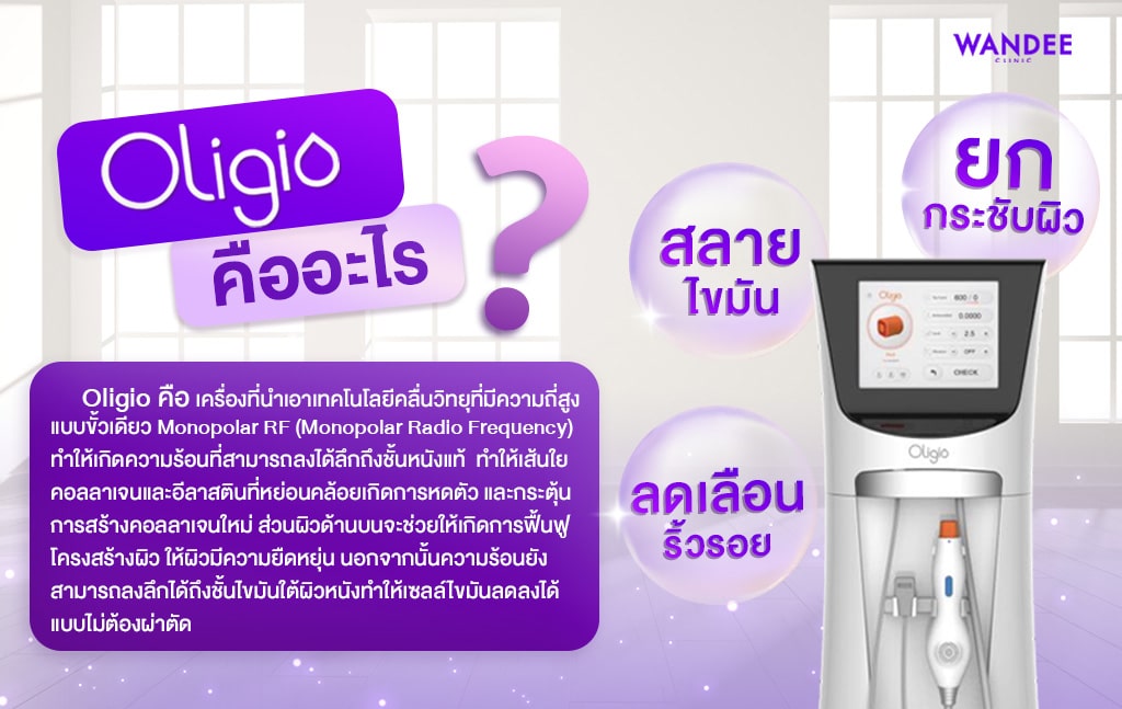 oligio คืออะไร ทำงานอย่างไร ดีหรือไม่