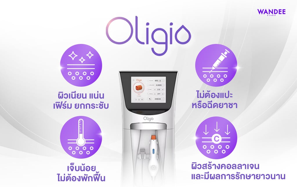 oligio มีข้อดีอะไรบ้าง