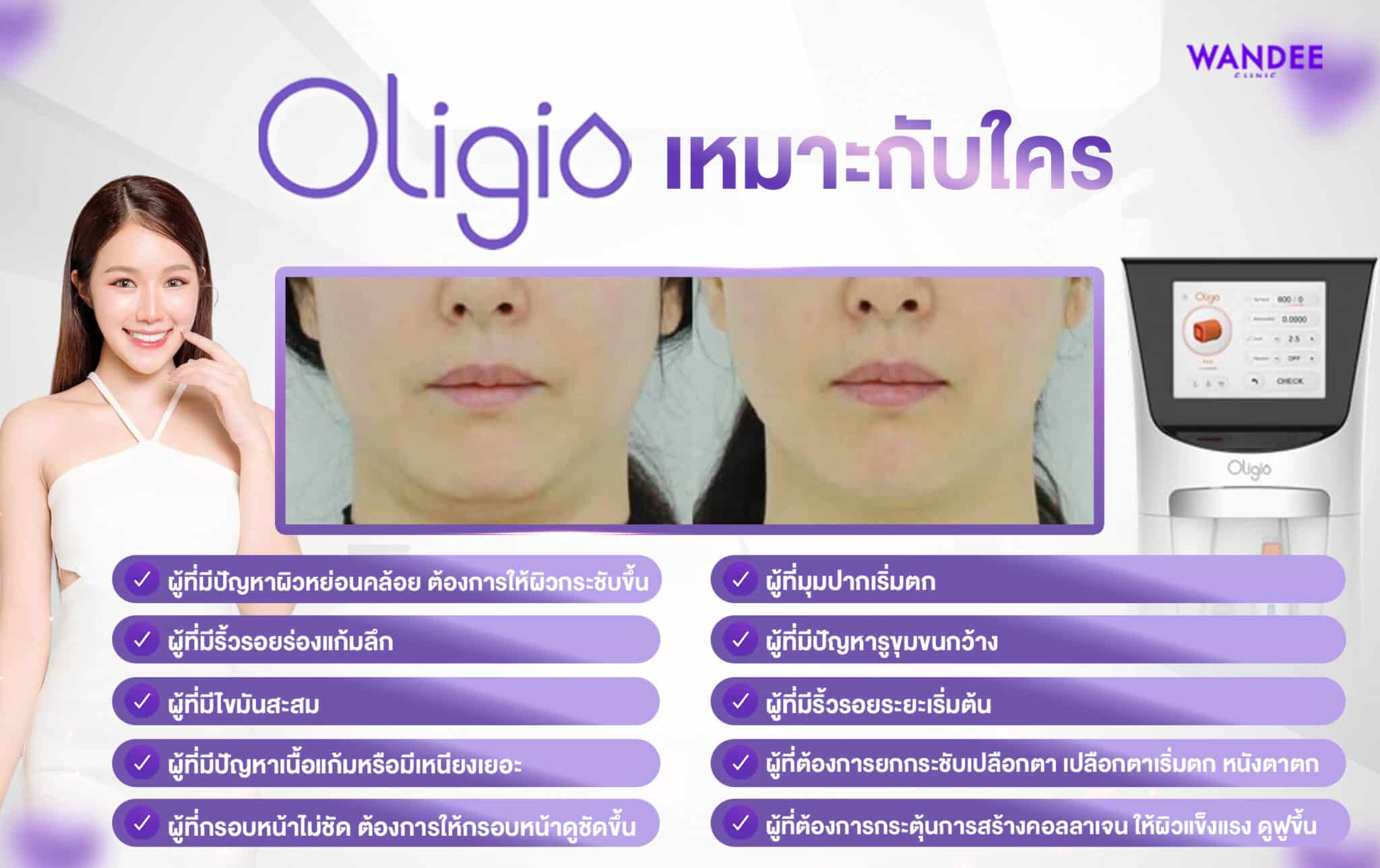 oligio เหมาะกับใคร ใครบ้างควรทำ