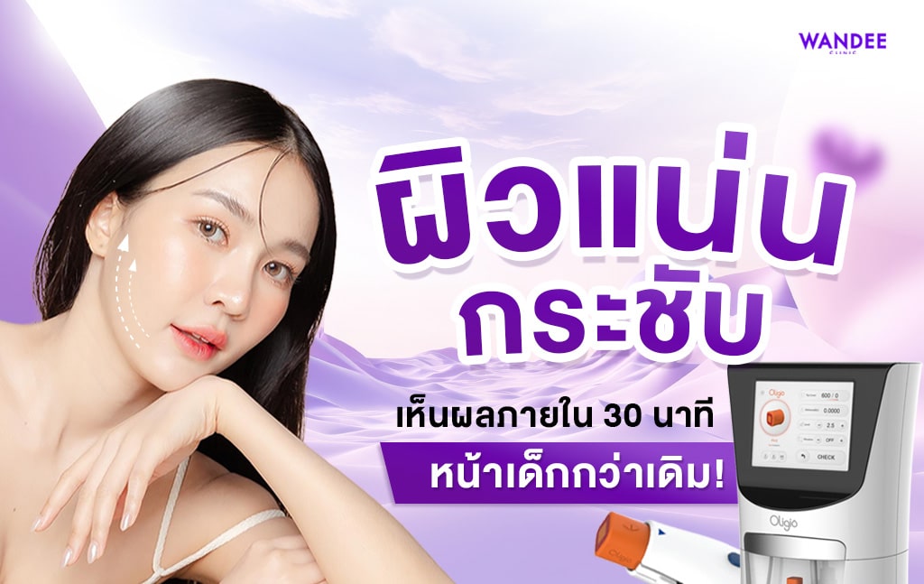 oligio ตัวช่วยผิวยก กระชับ