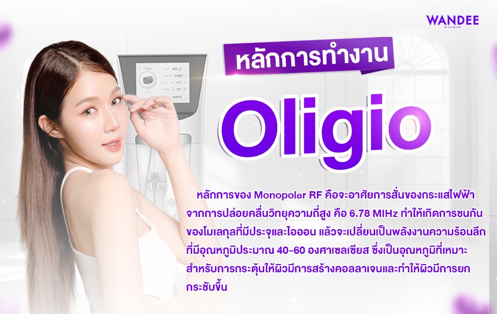 oligio หลักการทำงานคืออย่างไร ทำงานอย่างไรบ้าง