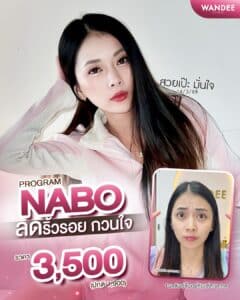 𝗣𝗿𝗼𝗴𝗿𝗮𝗺 𝗡𝗔𝗕𝗢 ลดริ้วรอยทั่วหน้า