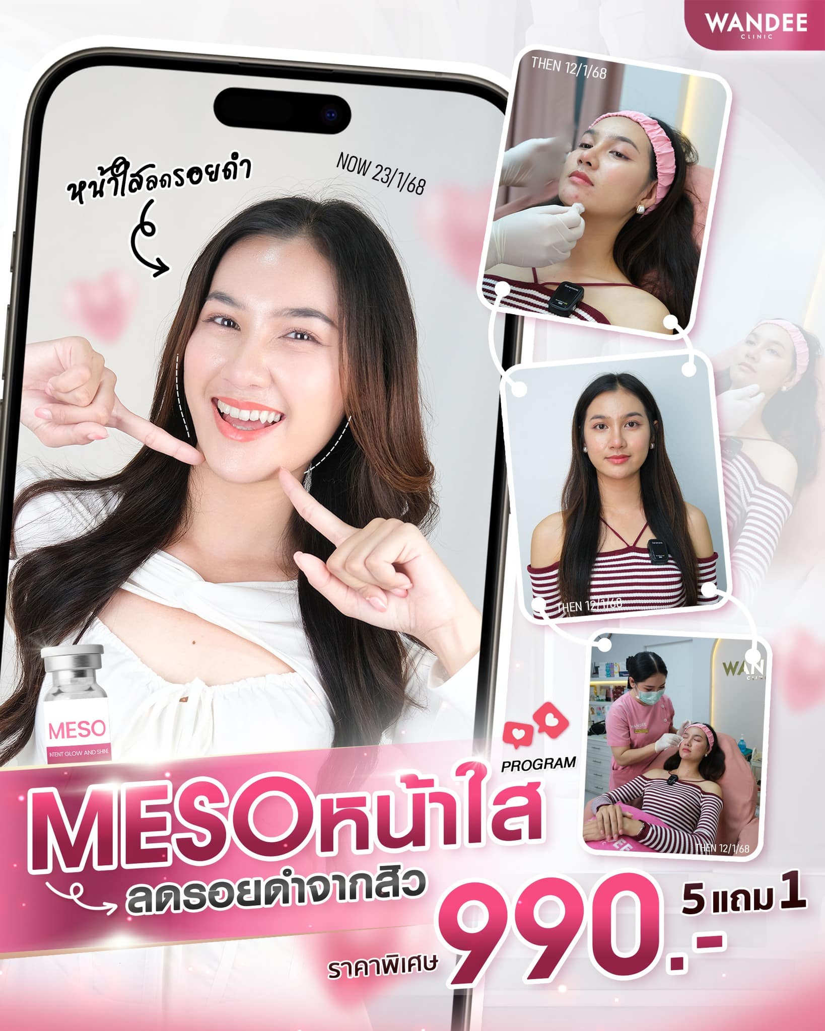 หมดปัญหารอยดำกวนใจ