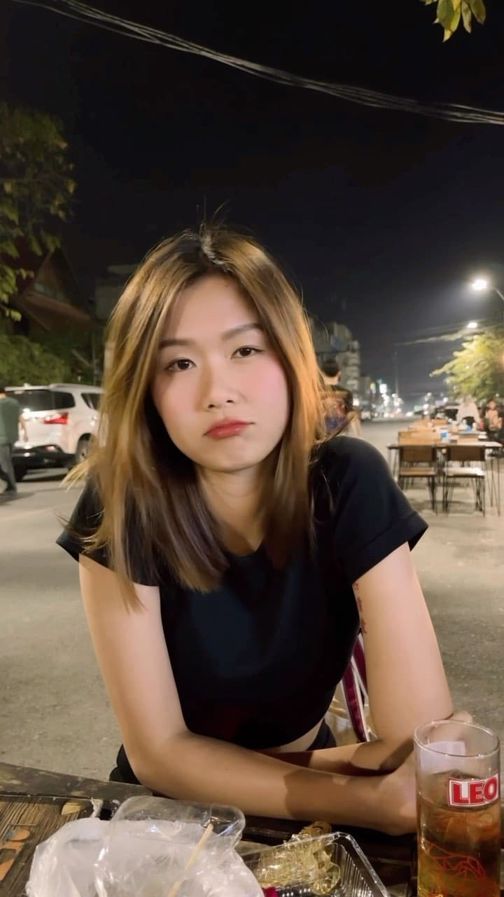 ฟิลเลอร์ปรับรูปหน้า จ๋อมแจ๋ม