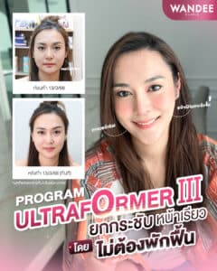 program ultraformer