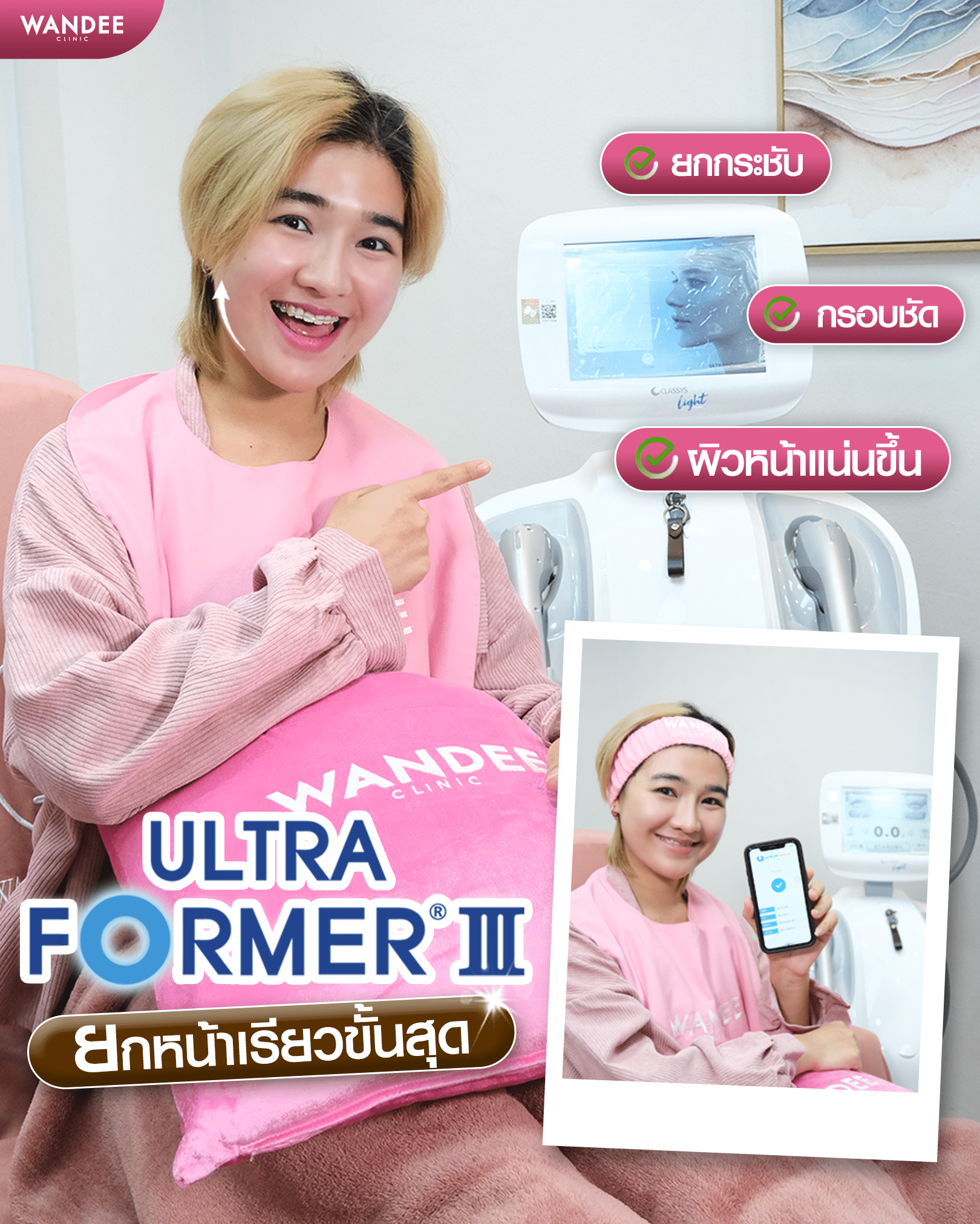 อัลตร้าฟอเมอร์ มะปราง