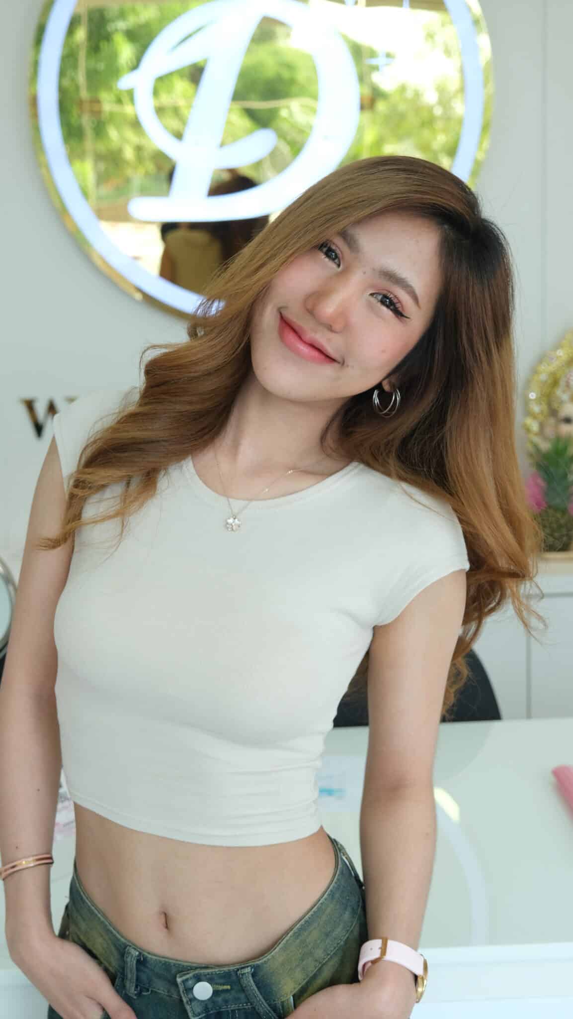 ฟิลเลอร์ เจลลี่