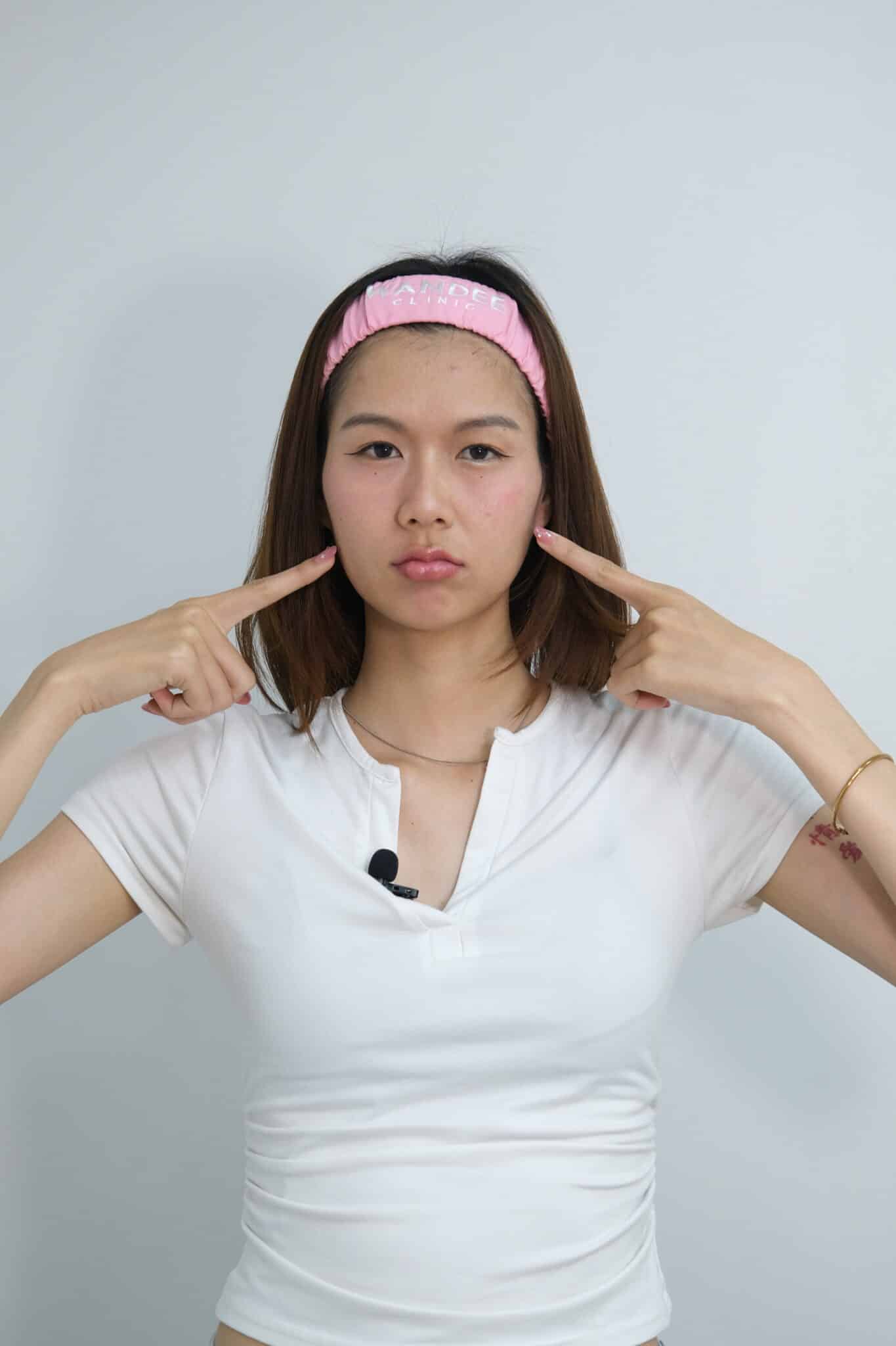 ฟิลเลอร์ปรับรูปหน้า จ๋อมแจ๋ม