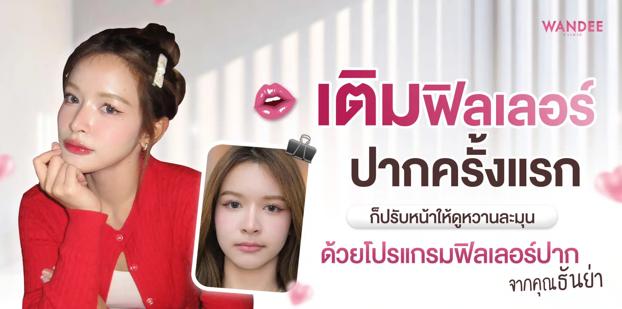 ฟิลเลอร์ปาก ธันย่า