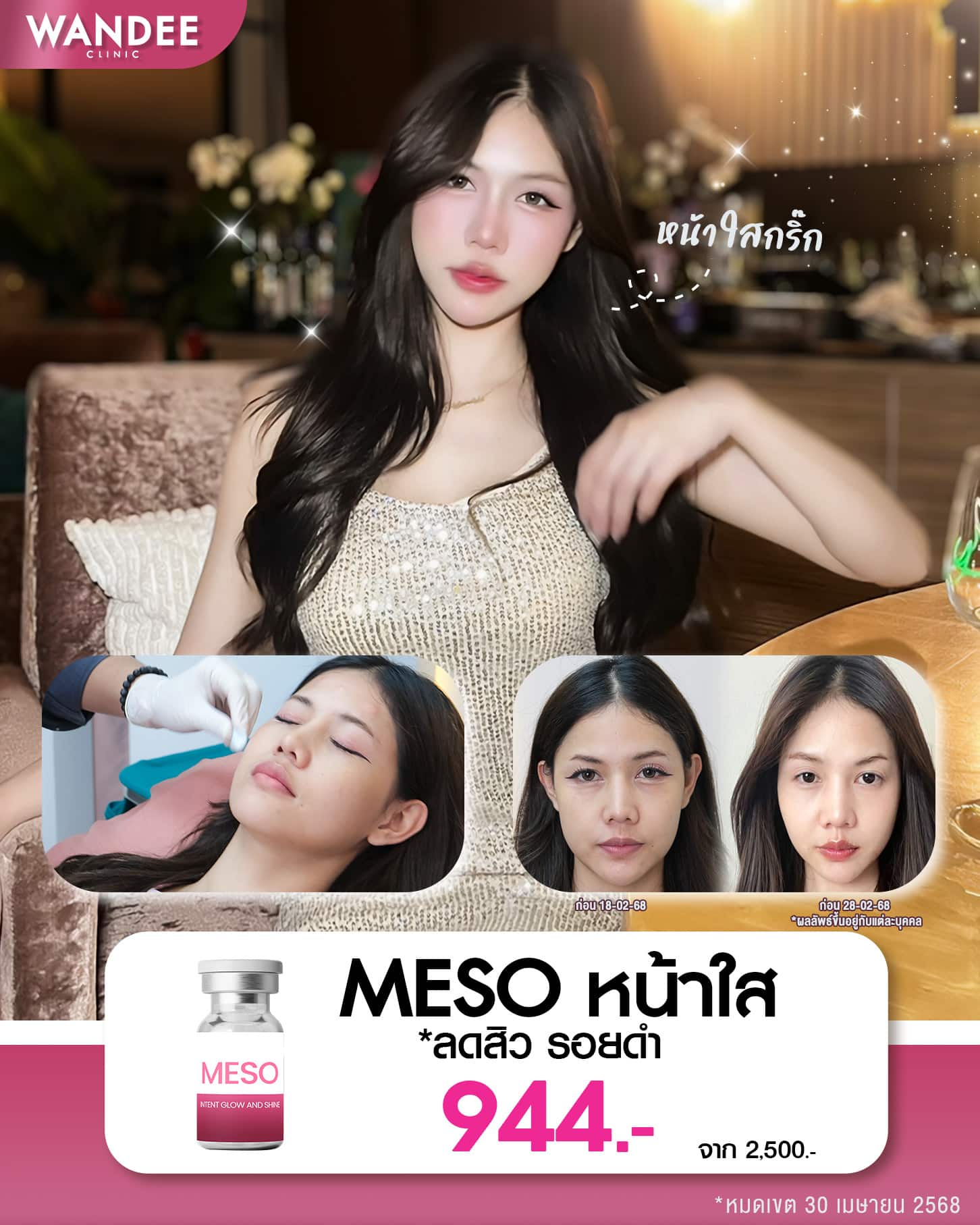 หน้าใส ลดสิว