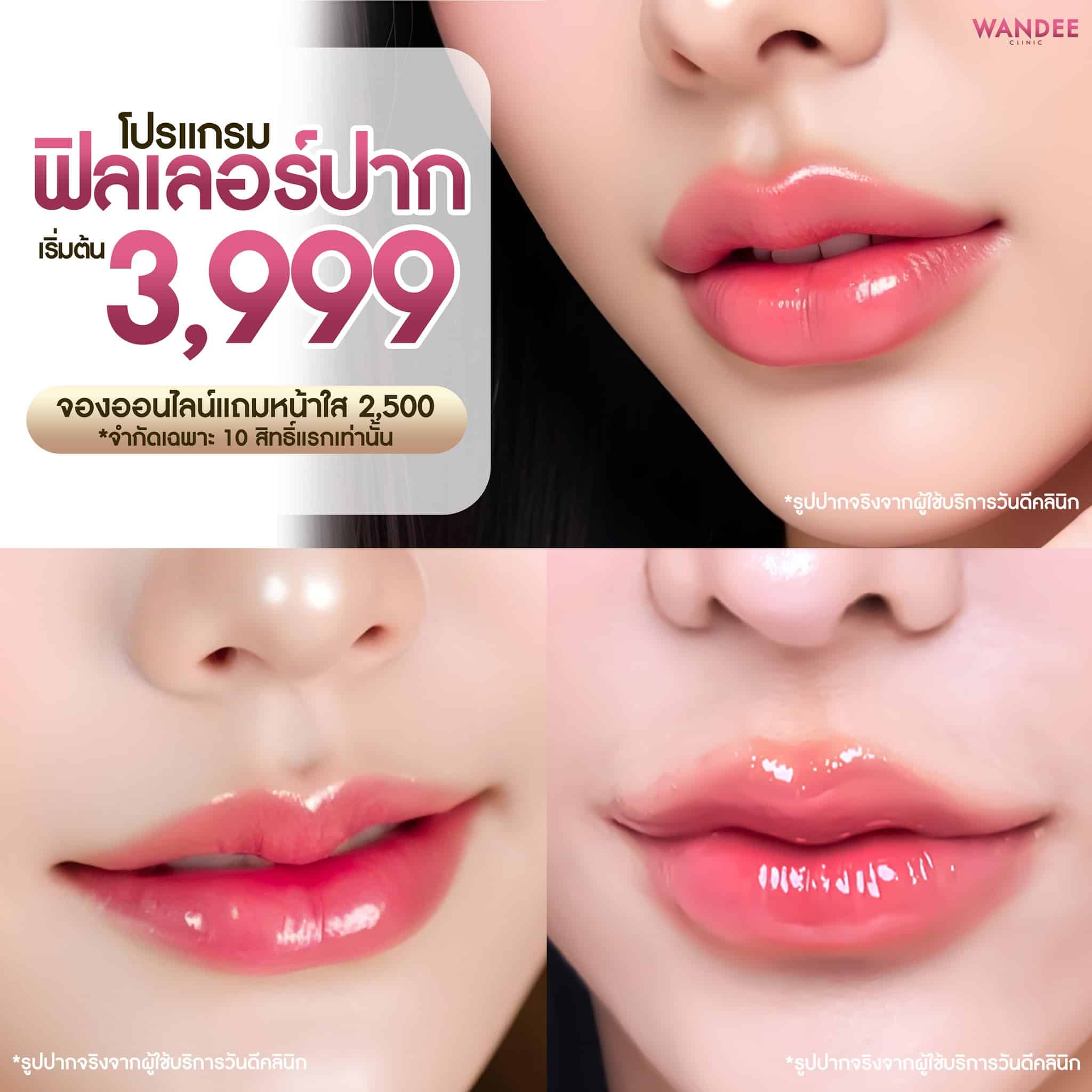 program filler ปาก