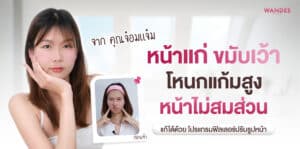 ฟิลเลอร์ จ๋อมแจ๋ม