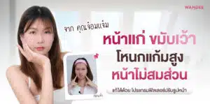 ฟิลเลอร์ จ๋อมแจ๋ม