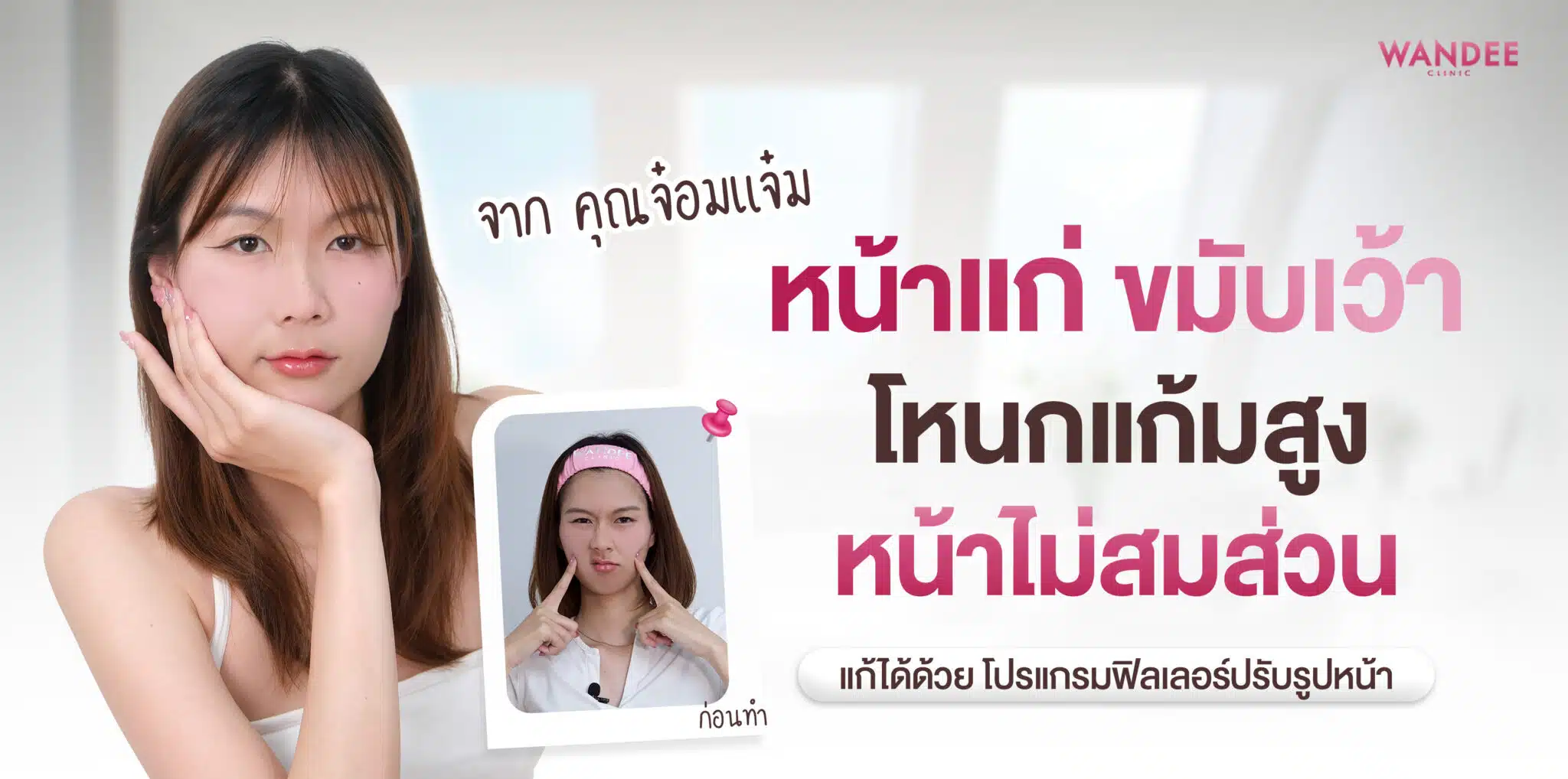 ฟิลเลอร์ จ๋อมแจ๋ม