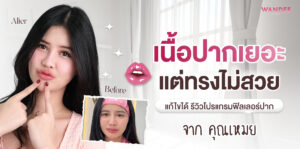 ฟิลเลอร์ปาก เหมย