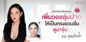 ฟิลเลอร์ปาก ต้นน้ำ