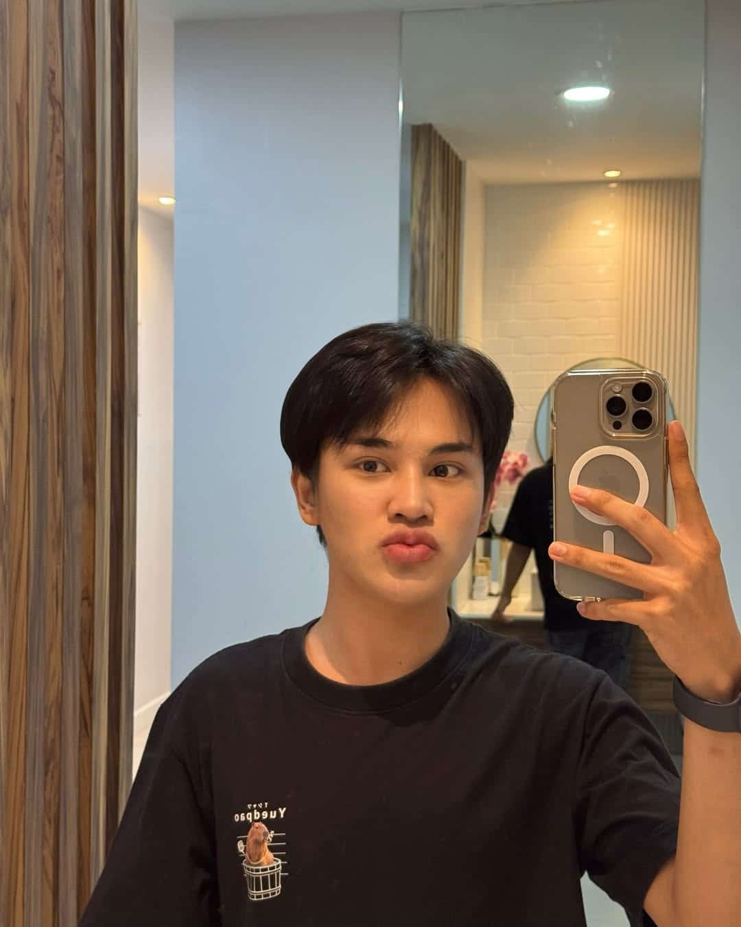 ฟิลเลอร์ปาก+ใต้ตา