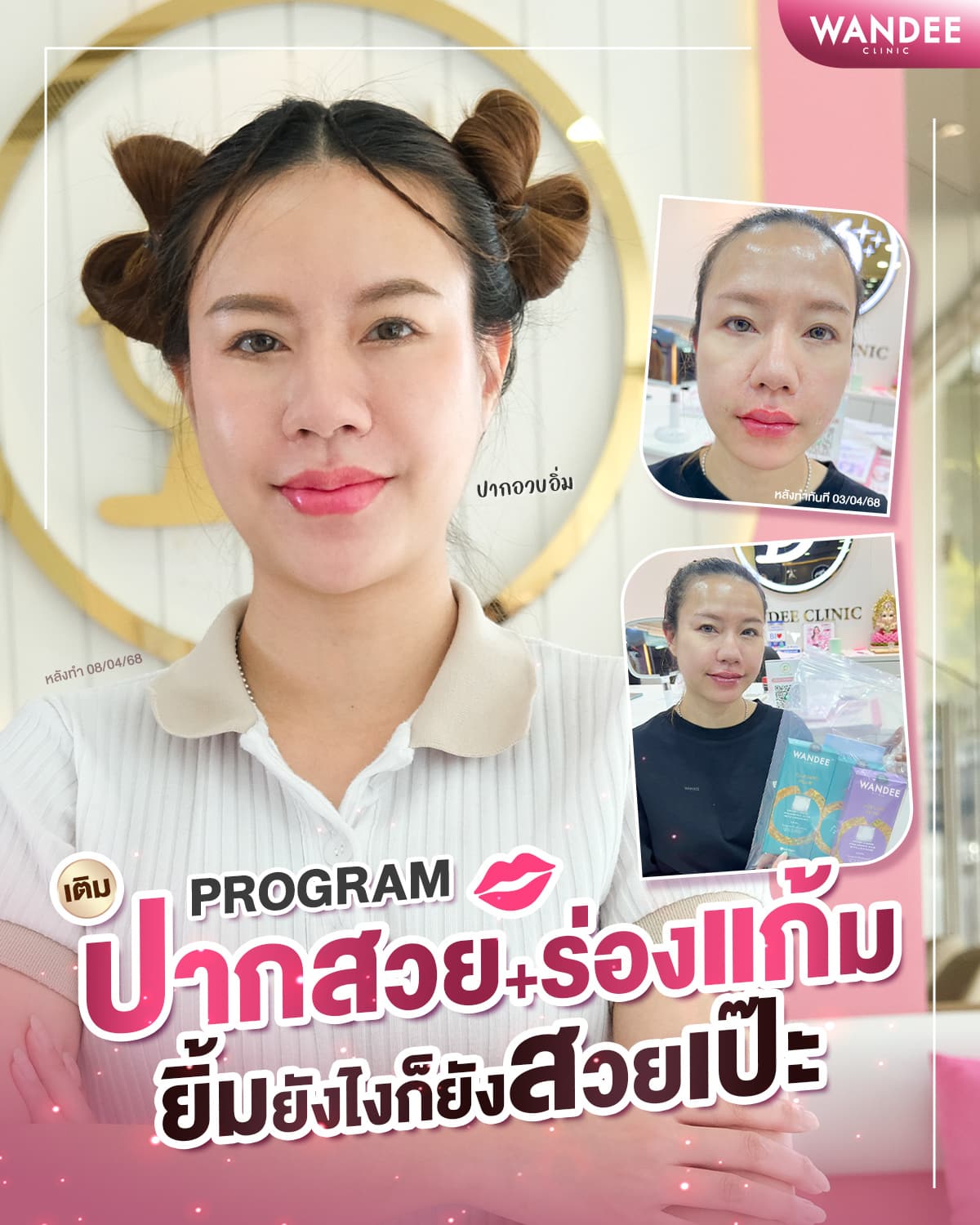 ยิ้มยังไงก็สวยเป๊ะ