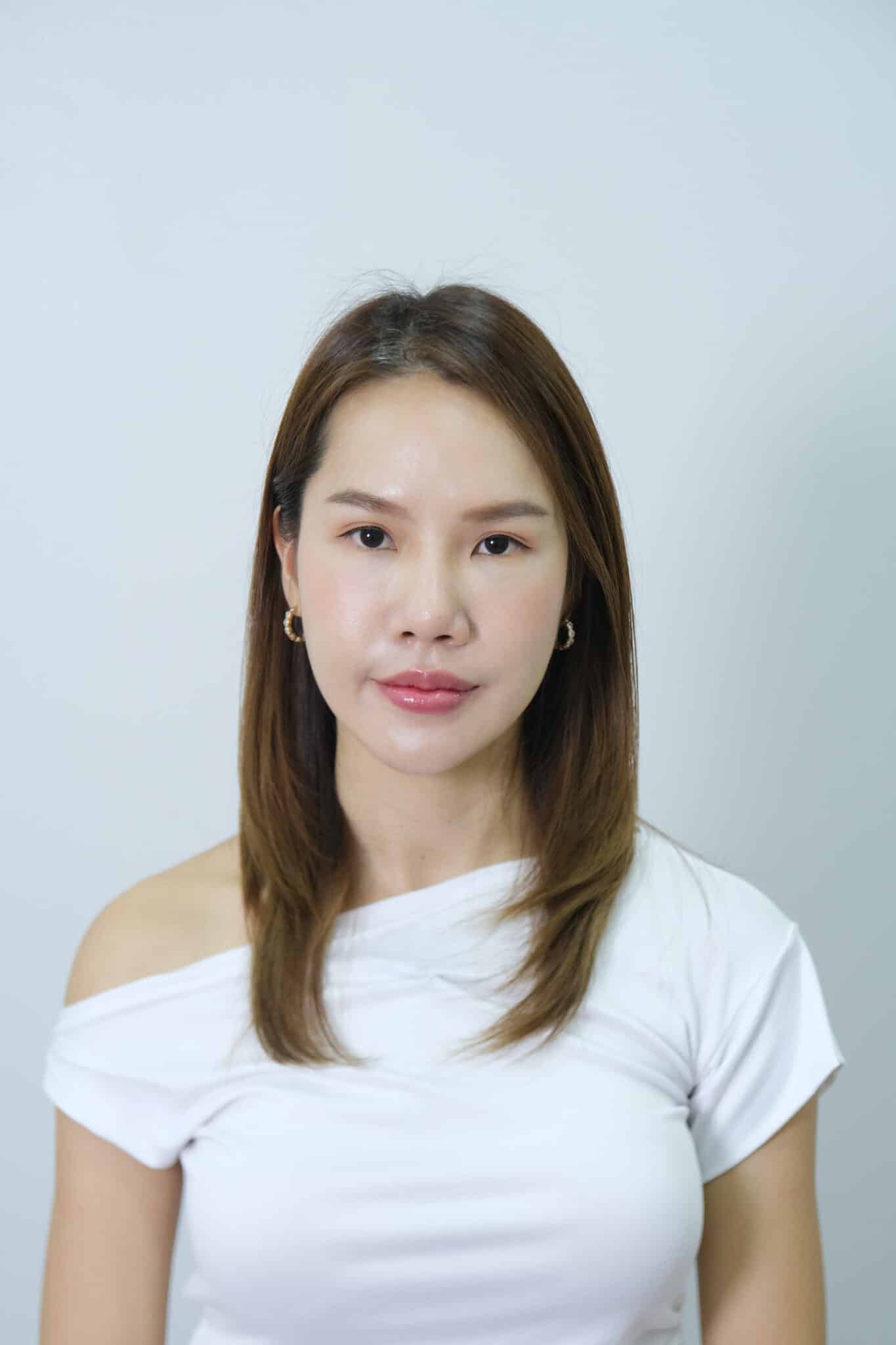 รีวิวโปรแกรม-Sculptra-มาย