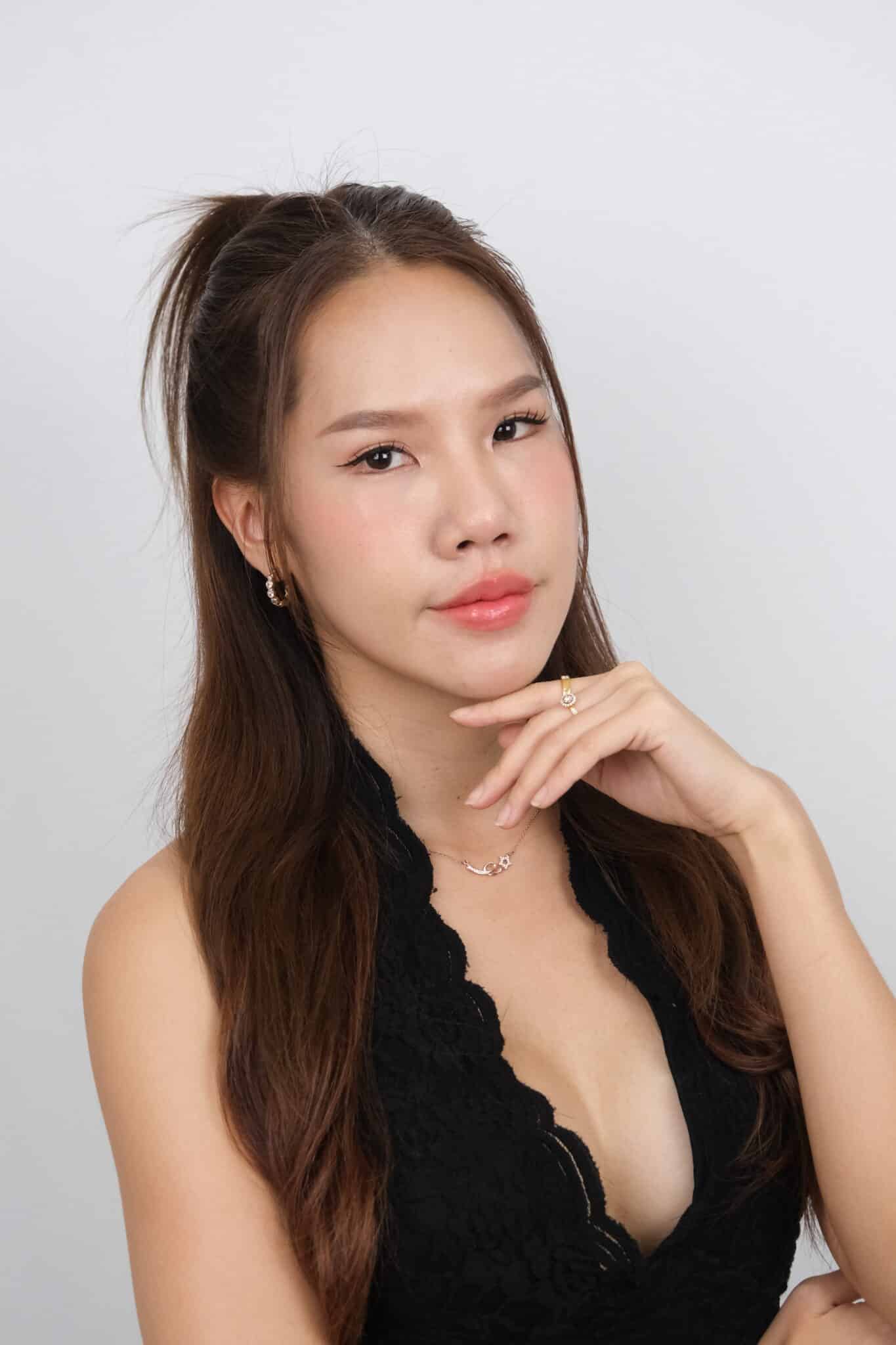 รีวิวโปรแกรม-Sculptra-มาย