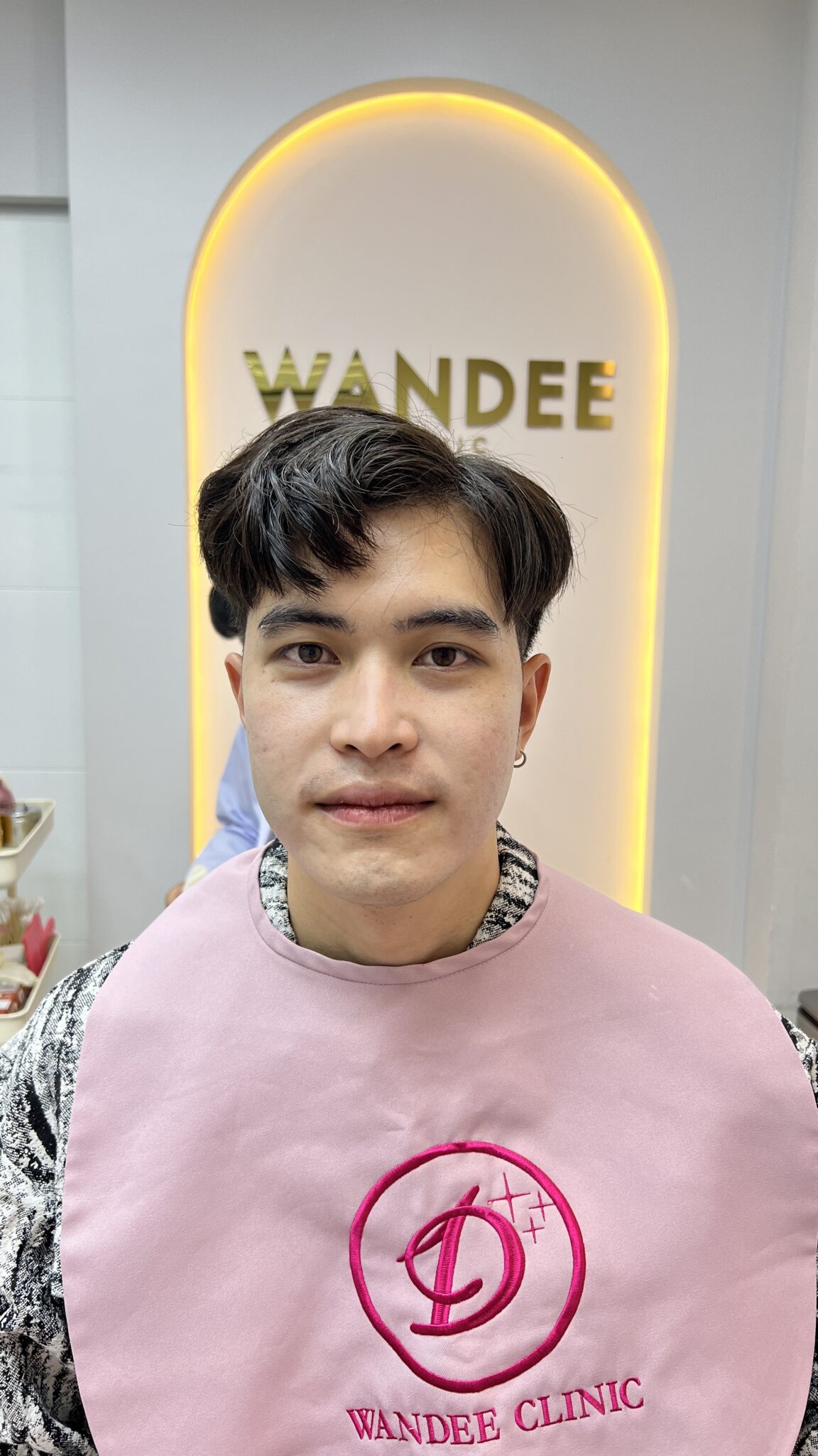 รีวิว Ultraformer 3