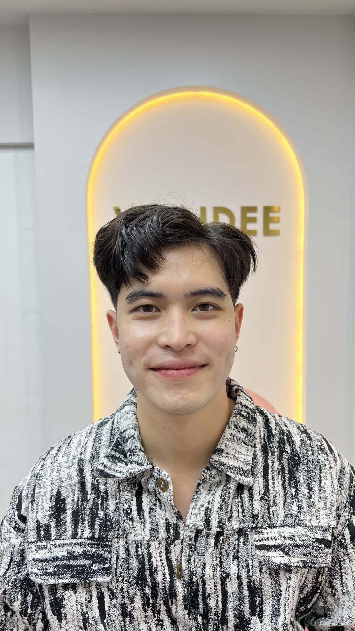 รีวิว Ultraformer 3