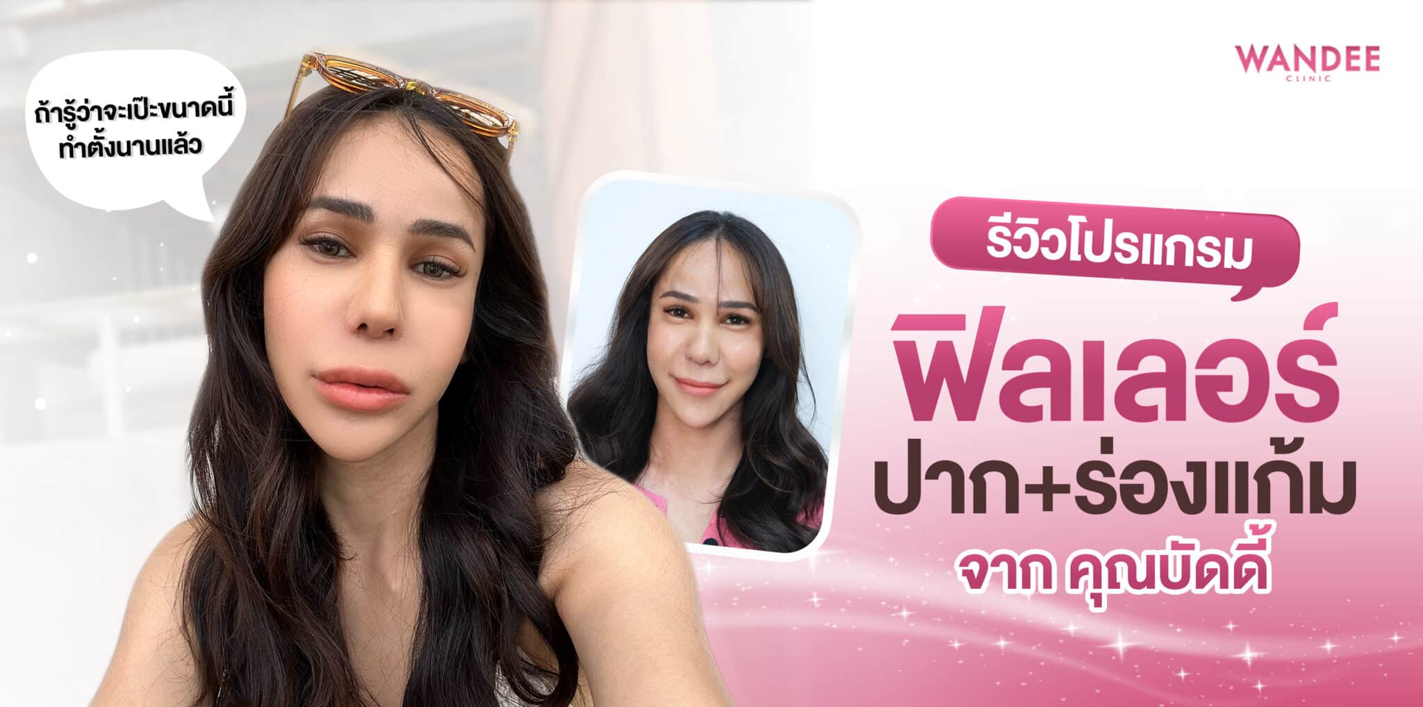 รีวิวโปรแกรม-ฟิลเลอร์-บัดดี้