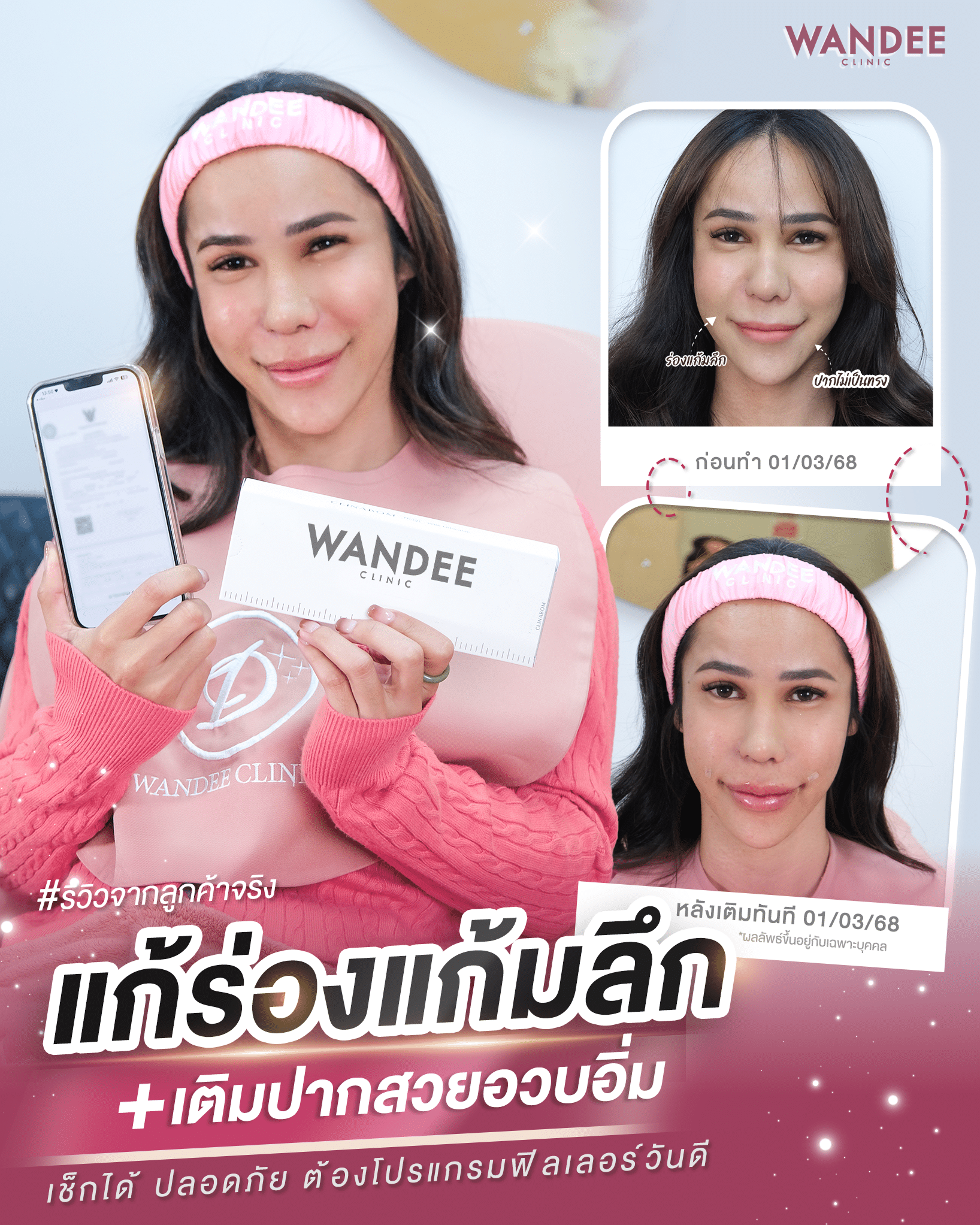 รีวิวโปรแกรม-ฟิลเลอร์-บัดดี้